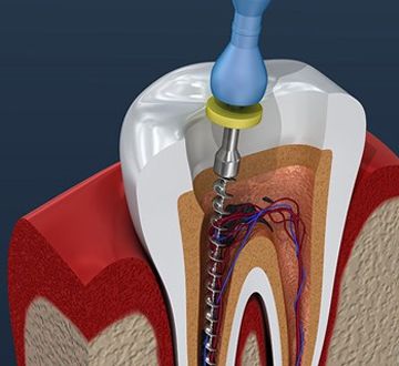 Endodontia